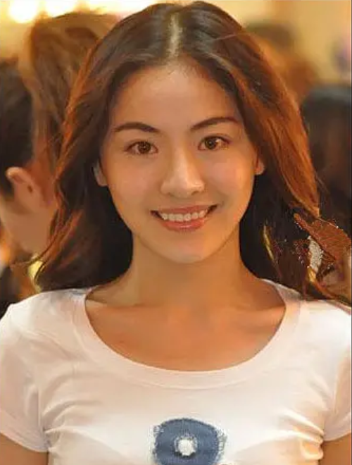 神似张柏芝的贡米跑去整容了！曾经的神颜如今模样大变，让人唏嘘