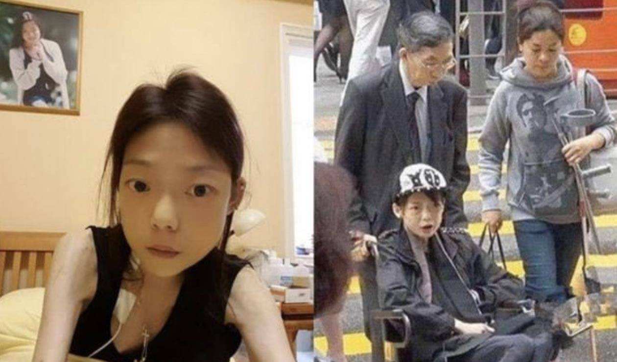 瘦到病态、整容成瘾，痴迷于少女人设，内娱的畸形审美太可怕