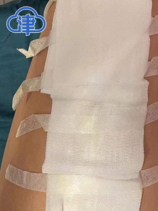 喆啡酒店淋浴房玻璃炸裂，住客受伤谁之过？