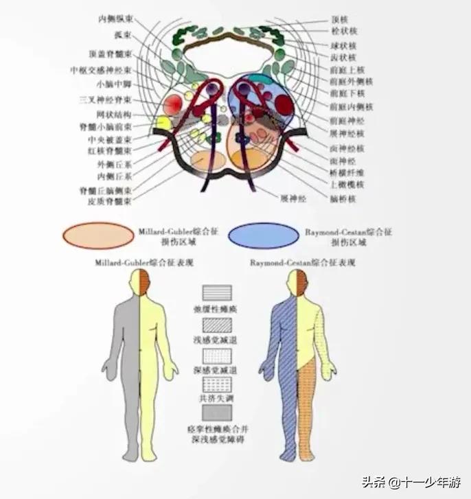 nba被动肌张力包括有哪些(运动系统解剖、生理及损害表现)