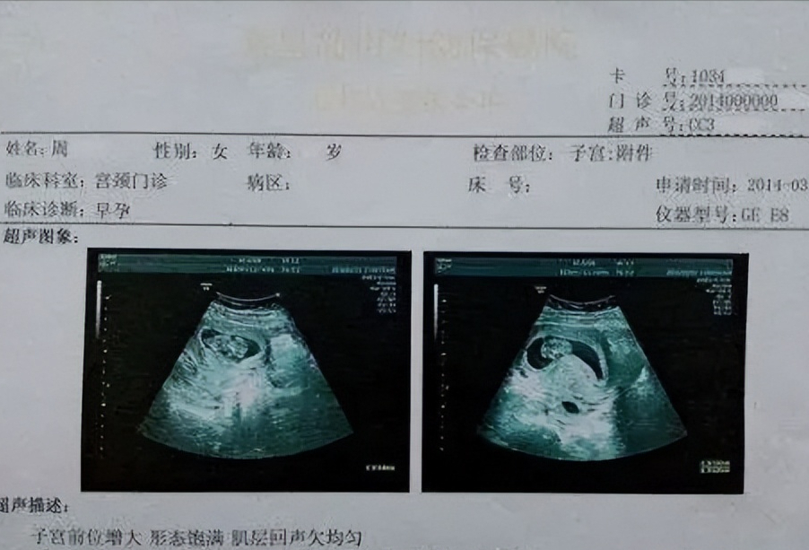 b超数据看胎儿性别（可以从孕期症状看出胎儿性别？）