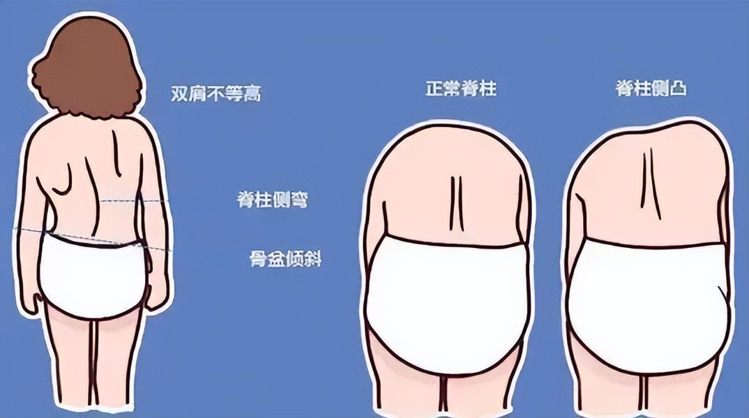 高性价比人体工学椅为你“撑腰”，科学减轻腰颈负担