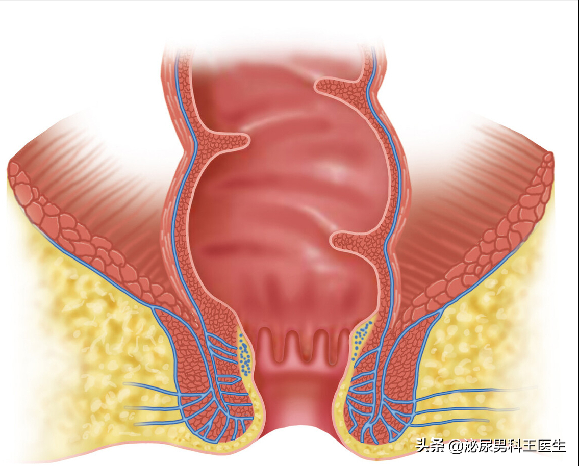 肛瘘患者：“不想治了，我真的太痛了！”肛瘘手术到底有多痛？