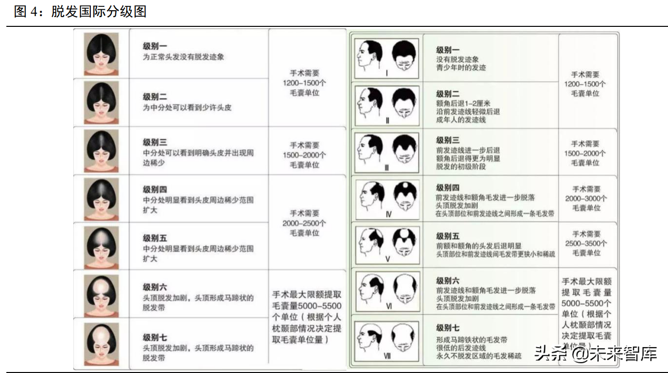 植发医疗行业专题报告：“头”等大事牵动千亿毛发市场