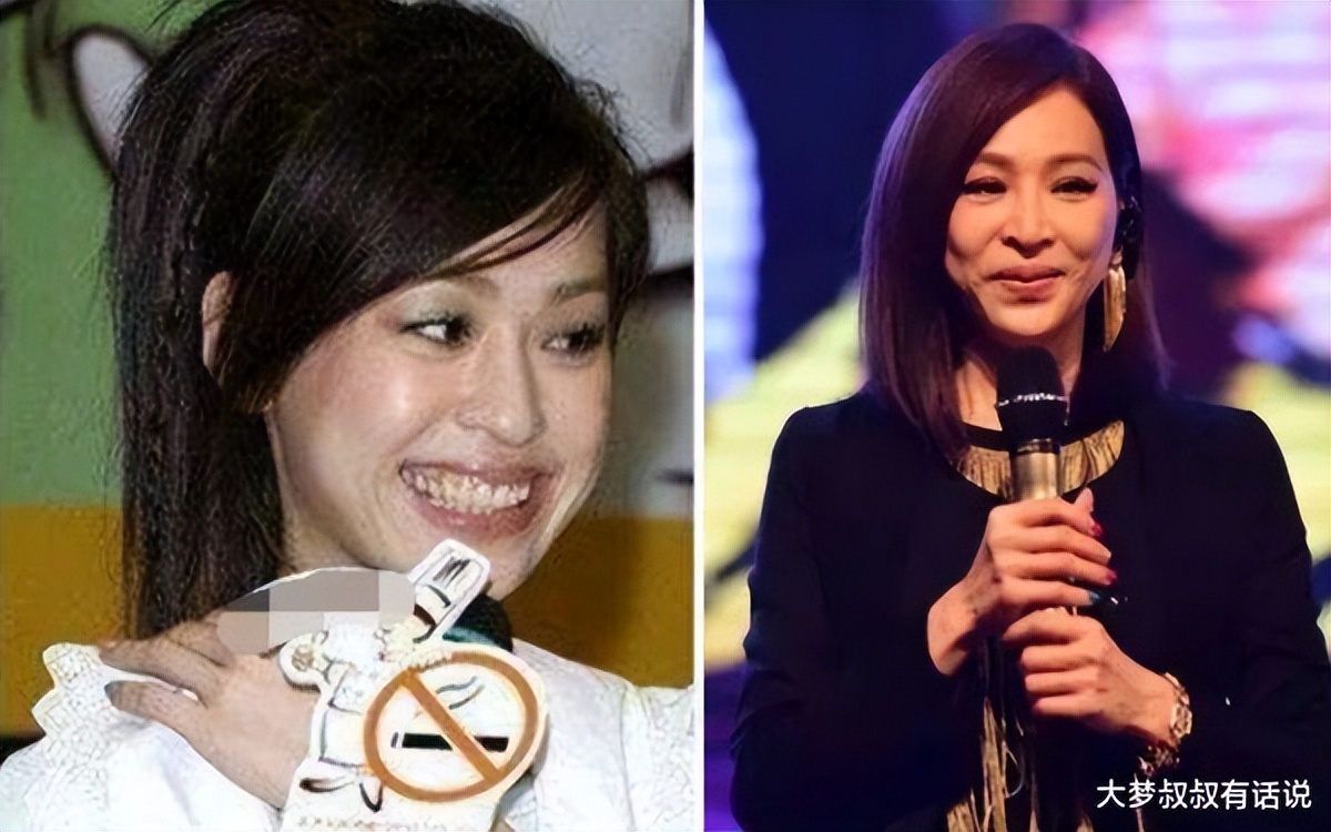 王心凌只能用左脸见人？她揭20年“不露右脸”背后真相