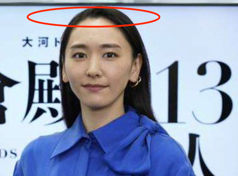 日本“国民女神”新垣结衣婚后首现身！发际线很高，额头上痣抢镜