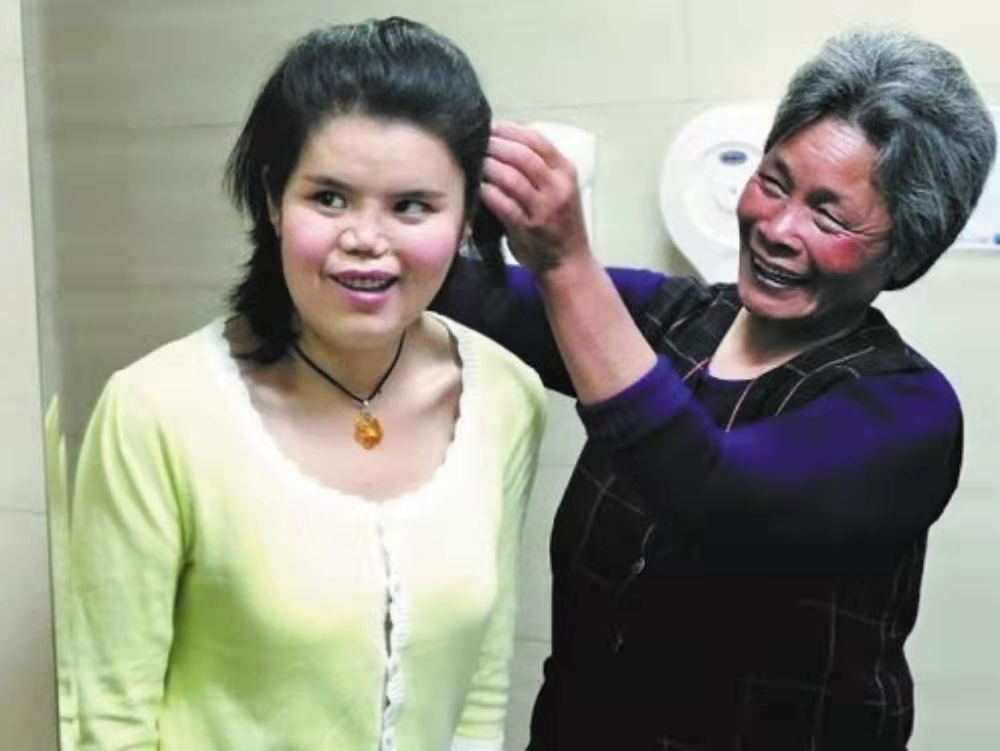 陕西农民捡到坑面女婴，哥哥做苦力为妹妹整容，变美后她嫁给哥哥