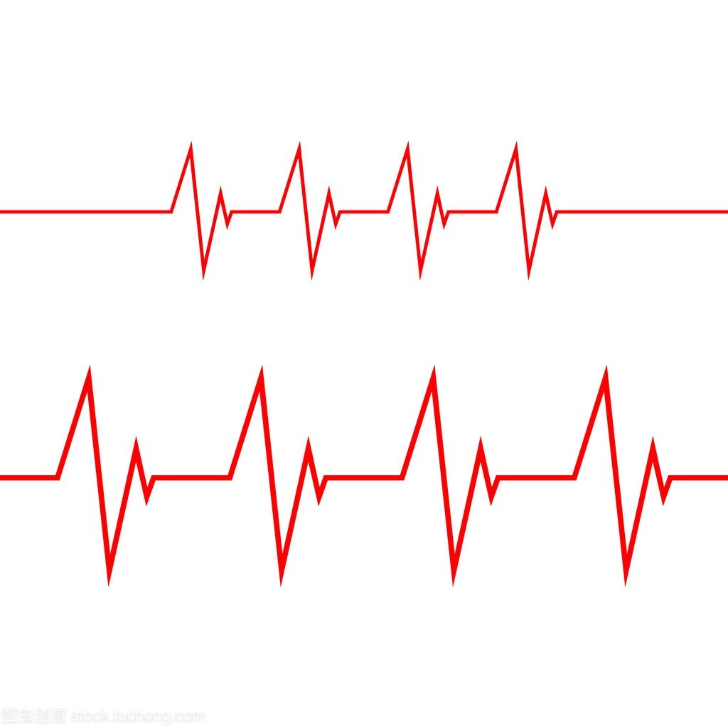 心电图检查正常,出院几天后离世!原因为何?