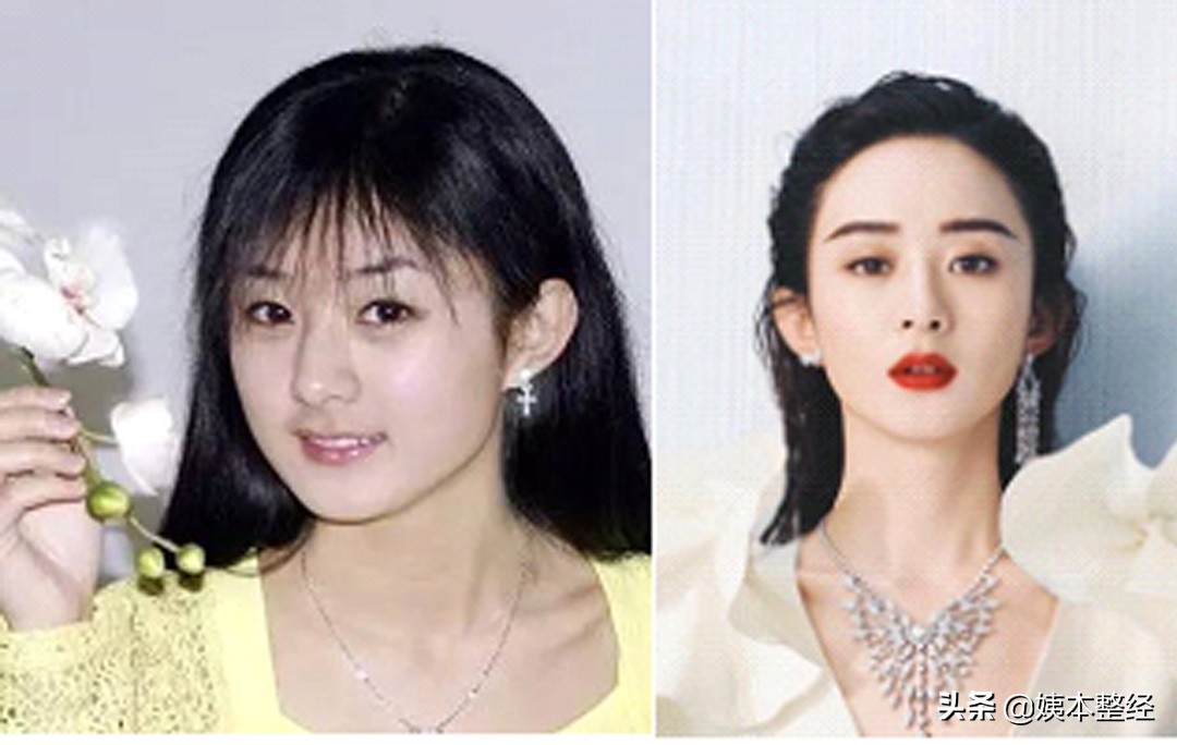 三个显土的长相特征，你中了几个？