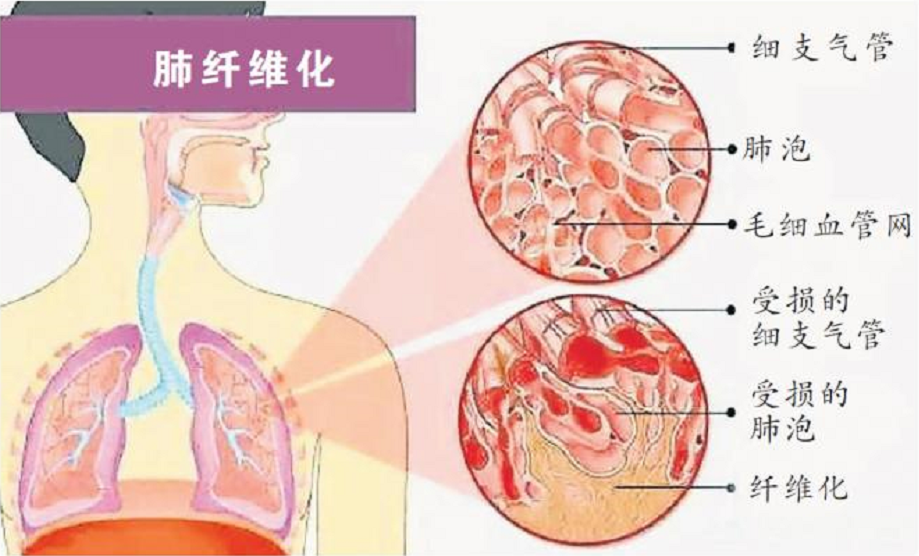 姐夫诱骗18岁女孩喝百草枯！无冤无仇，看似意外实则早有预谋