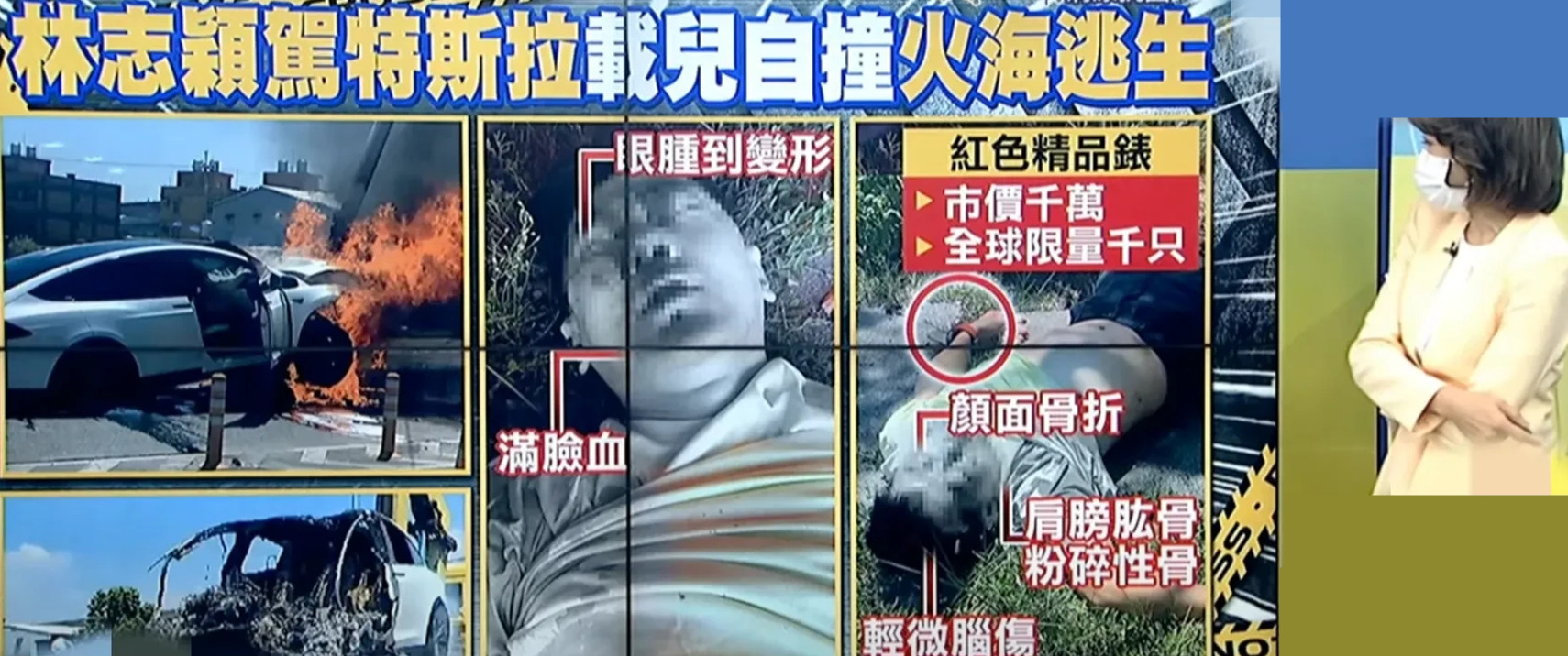 林志颖车祸细节曝光！火海逃生，颜面骨折需手术，未来2天是关键