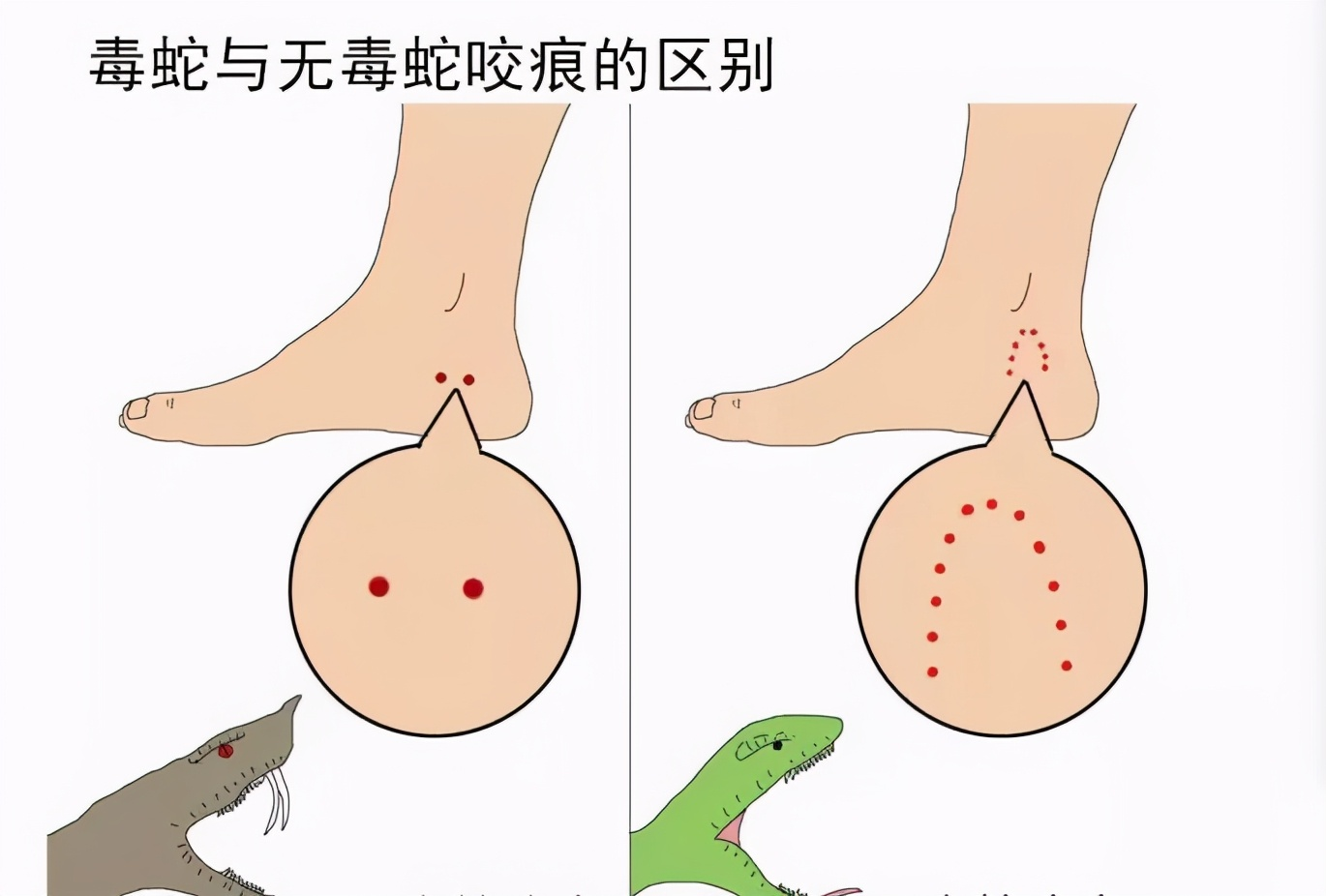 64岁阿姨被蛇咬中浑然不知,2次被咬才发现毒蛇,这究竟多危险?