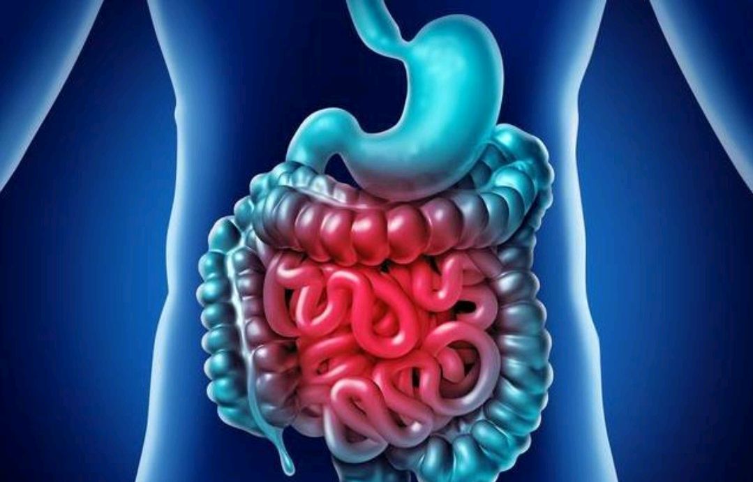 该清理肠道的垃圾了清理肠道垃圾