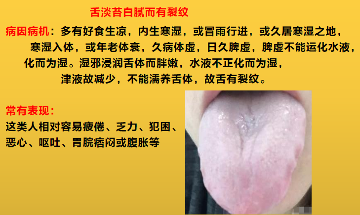 舌头边缘有齿痕，舌苔中间有裂纹？3种齿痕5种裂纹，你是哪一种？