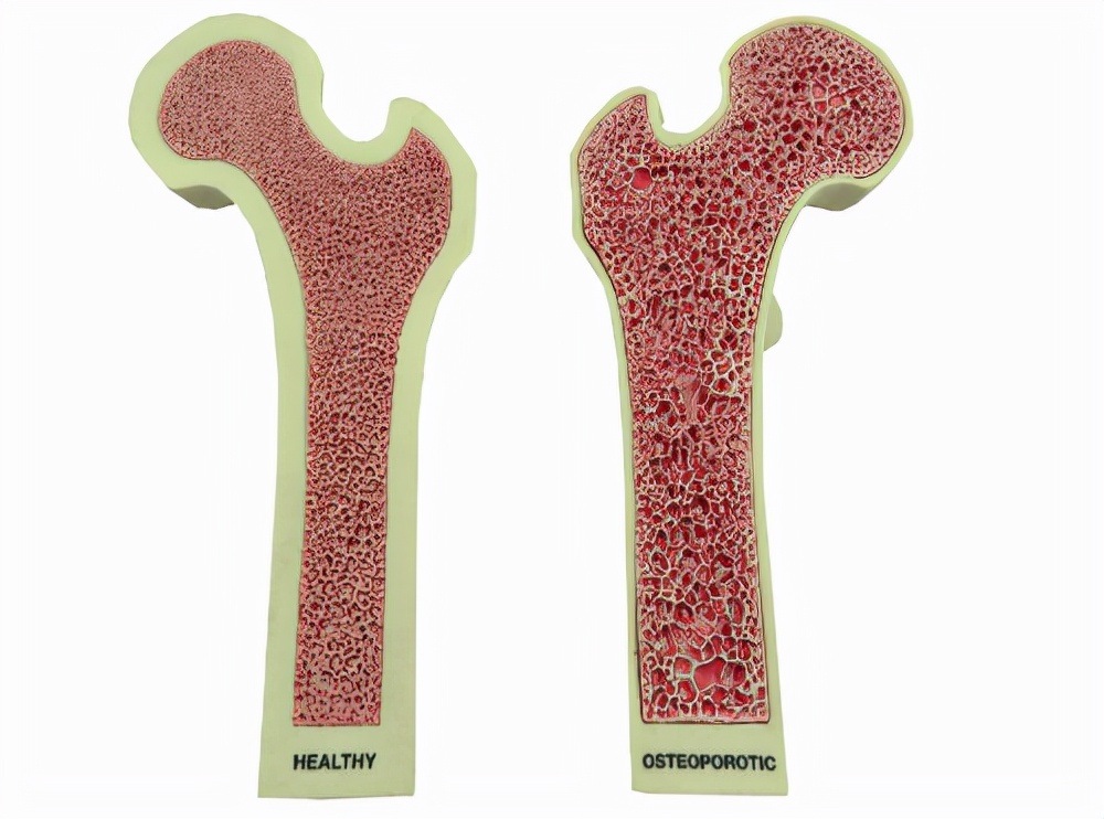 医生提醒：咖啡不仅是心血管杀手，长期喝咖啡还容易患上2类疾病