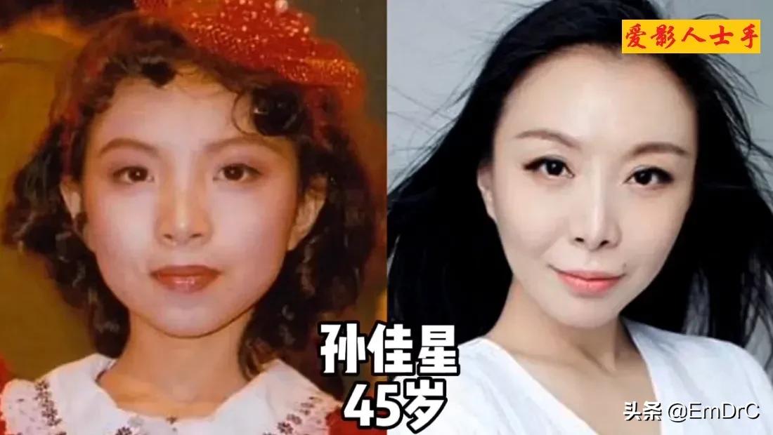 童星长大前后的对比差距很大