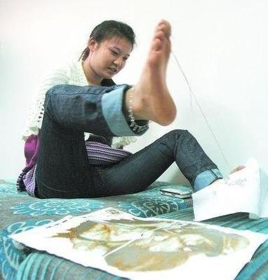 四川90后断臂女孩:3岁失去双臂,30岁成为超模,如今逆袭成明星