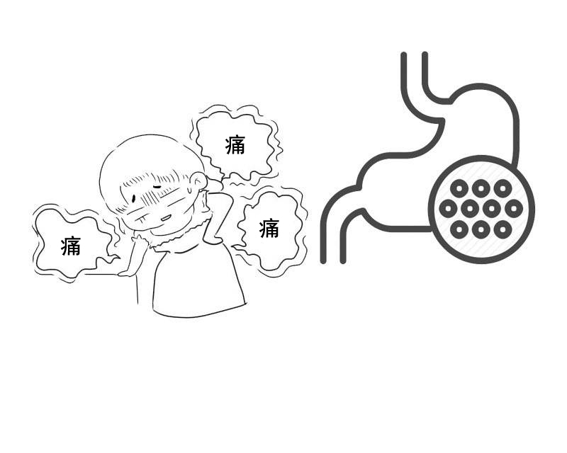 胃癌与胃病导致的疼痛有何区别？医生：很好区分，你不妨看看