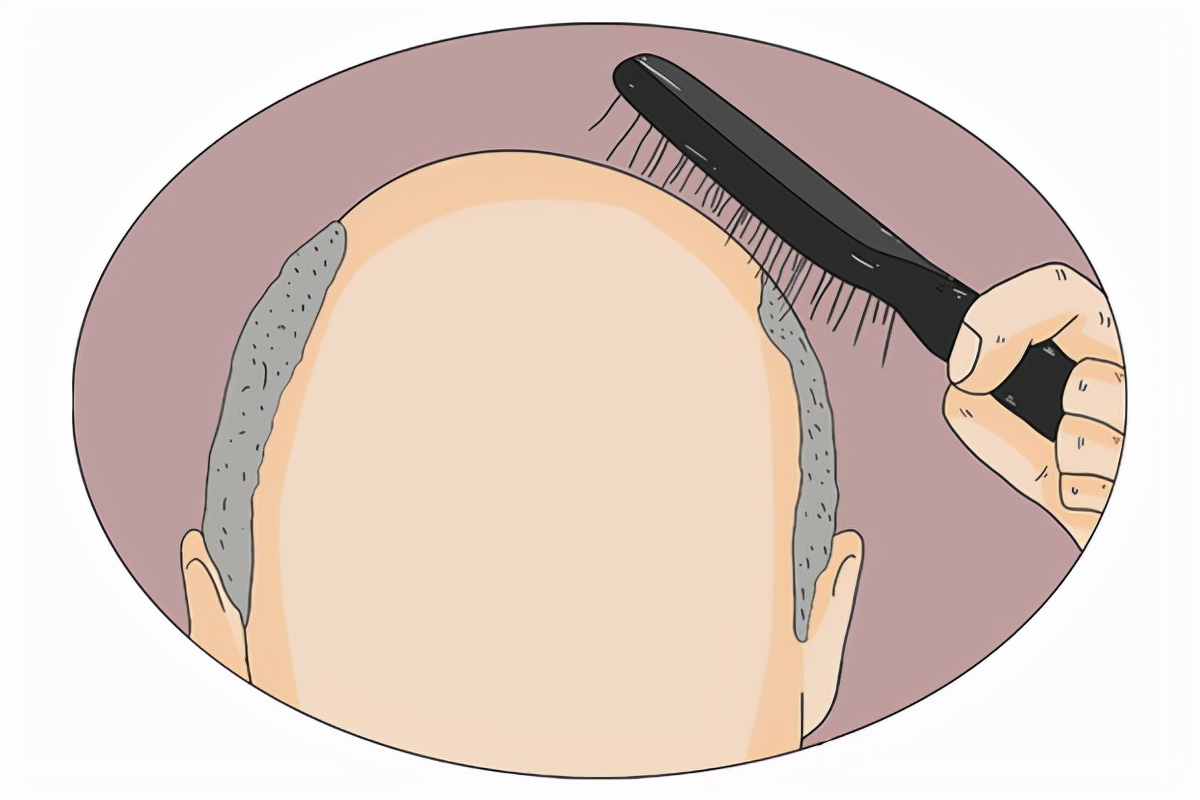 头发一掉一大把，怎么做才能挽救脱发？提醒：这5件事要做到位_就会
