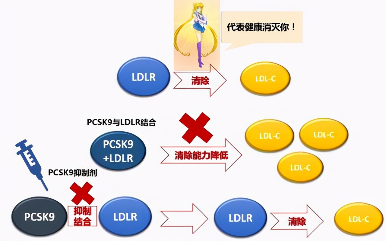 好消息：3个降脂新药纳入医保目录，如何合理应用？本文说清