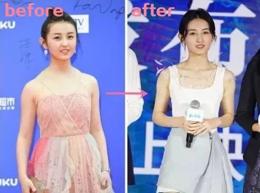 想拥有子枫妹妹同款的直角肩嘛？斜方肌还会越来越大？