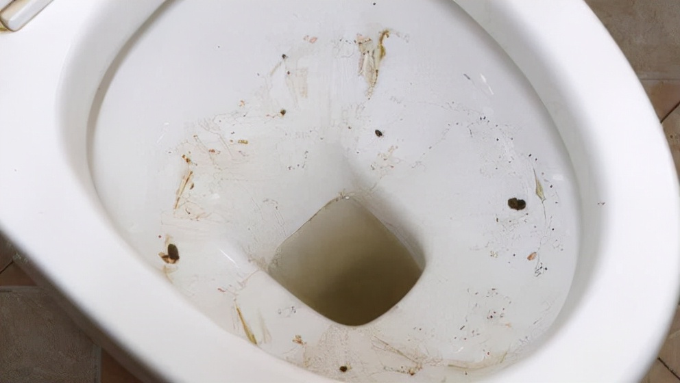 马桶里一圈黄色污垢怎么去除?保洁阿姨教你这么做,干净没异味