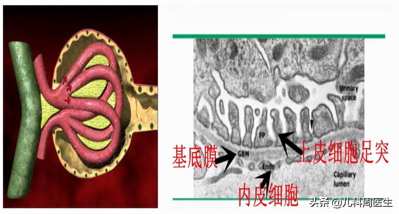 孩子睡醒眼皮肿成“灯泡”？医生说当心肾病，可以治但需注意4点