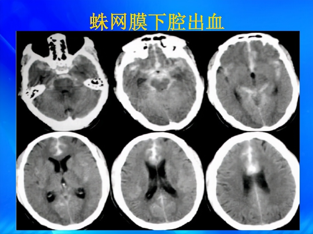 世上最痛的5种病，个个都堪称古代酷刑，经历过的都是超人