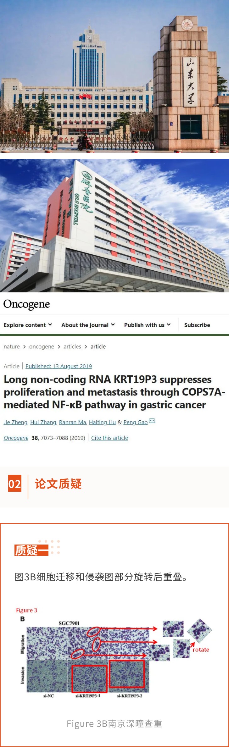 因细胞迁移和侵袭图部分重叠，山东大学发表的高分sci论文被质疑
