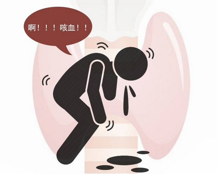 白天没事，晚上咳不停？这种咳嗽背后3个诱因你该早知道