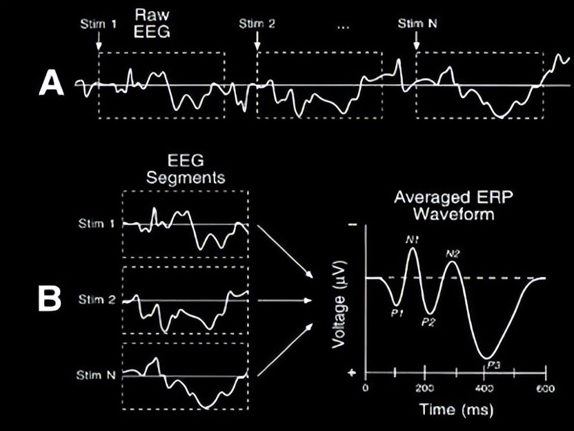 Mmn是什么意思(神经电生理评估方法解读｜脑电图（EEG）与事件相关电位（ERP）)