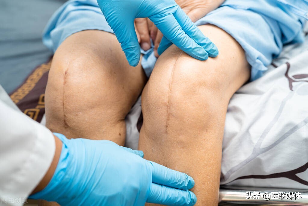 骨质增生压迫神经,要怎么办?一般来说,都靠这4个方法