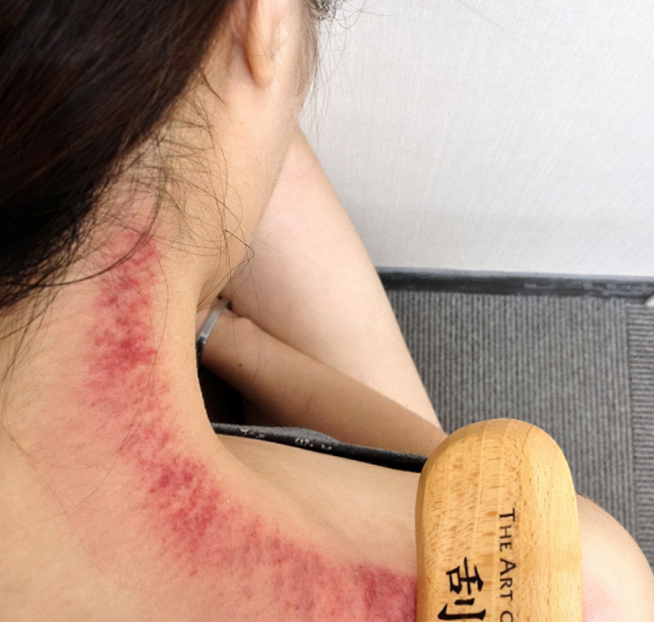 刮痧究竟是真养生，还是伪科学？刮出来的“痧”，到底是什么？