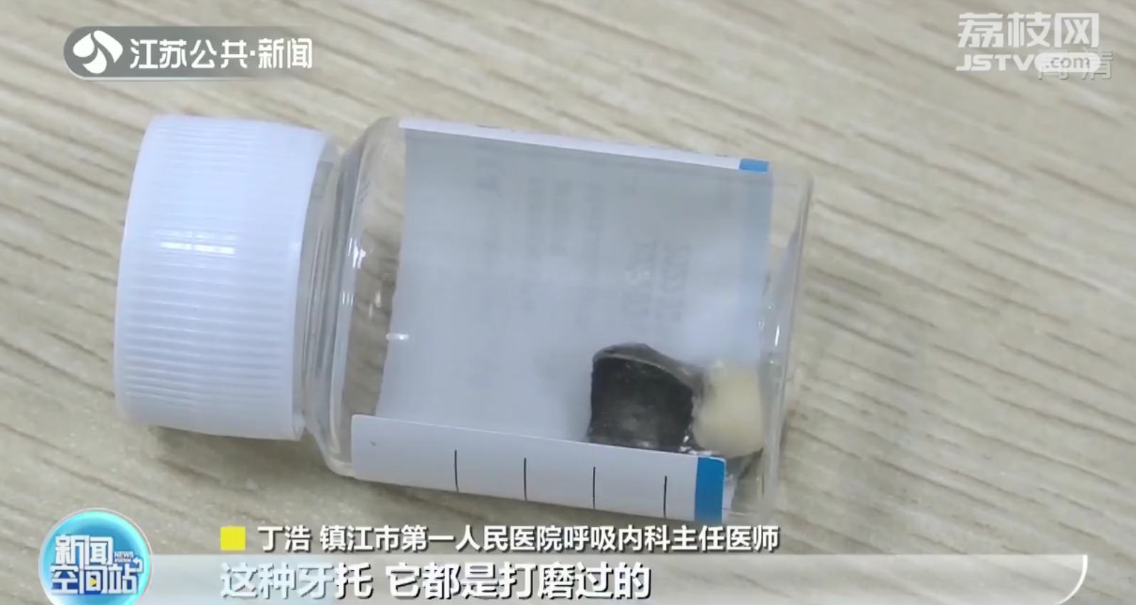 镇江大爷假牙掉入气管 医生巧妙拽出