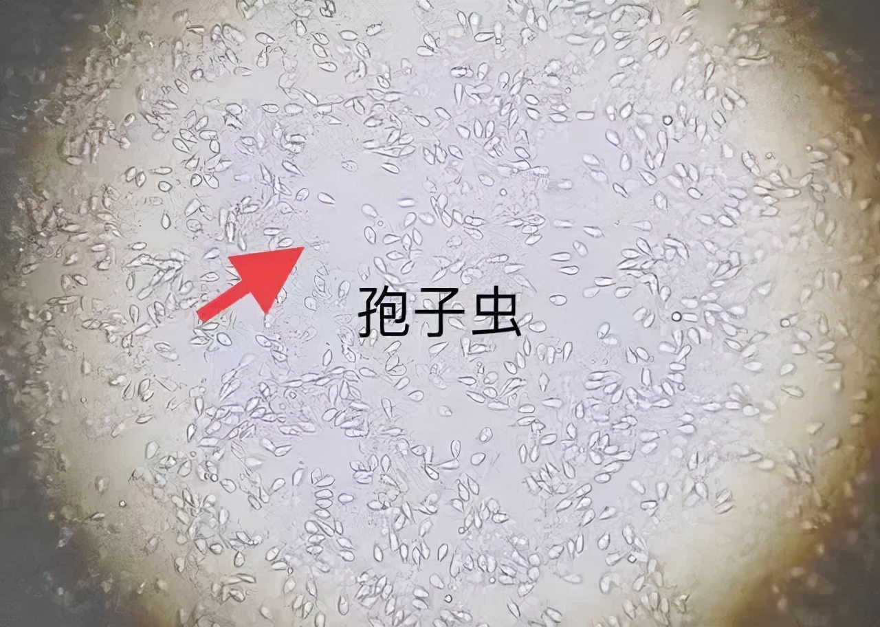 再看几张显微镜下孢子虫的照片发育为滋养体的孢子虫经过核分裂发育为