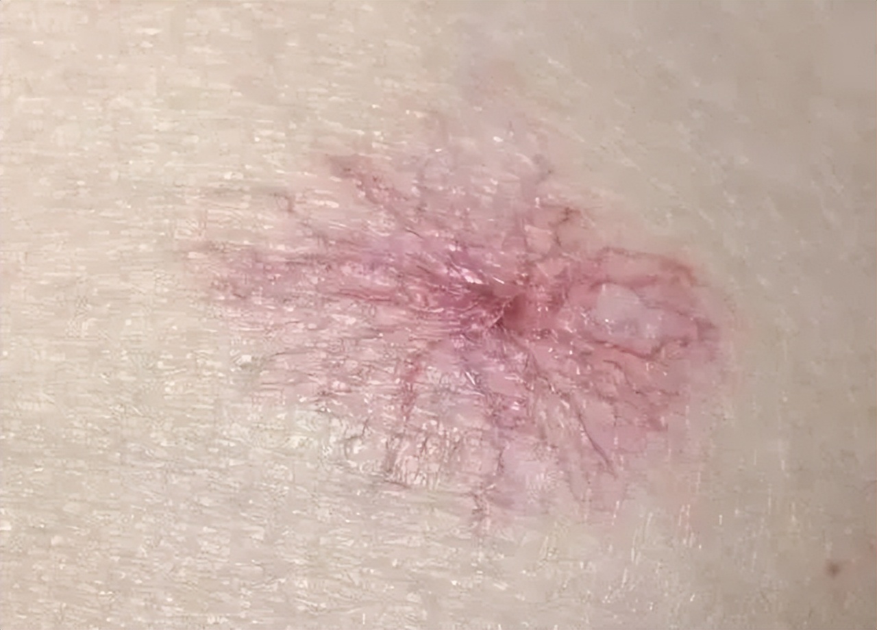 45岁科学家猝然离世：30岁后身体各器官的求救信号，早知道能救命