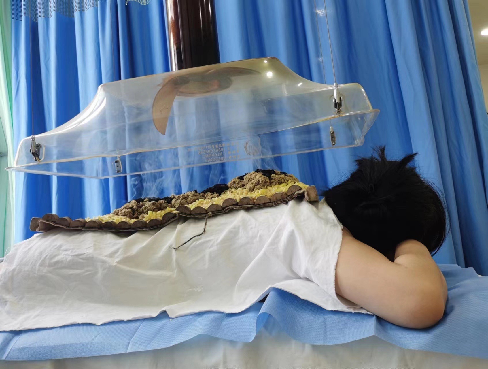 千寒易去,一湿难除!中医督脉灸祛湿疗受热捧