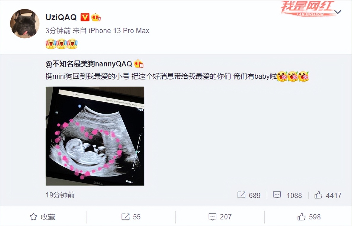 Uzi要做爸爸了！未婚妻晒出B超，网友：小小狗剑指S30