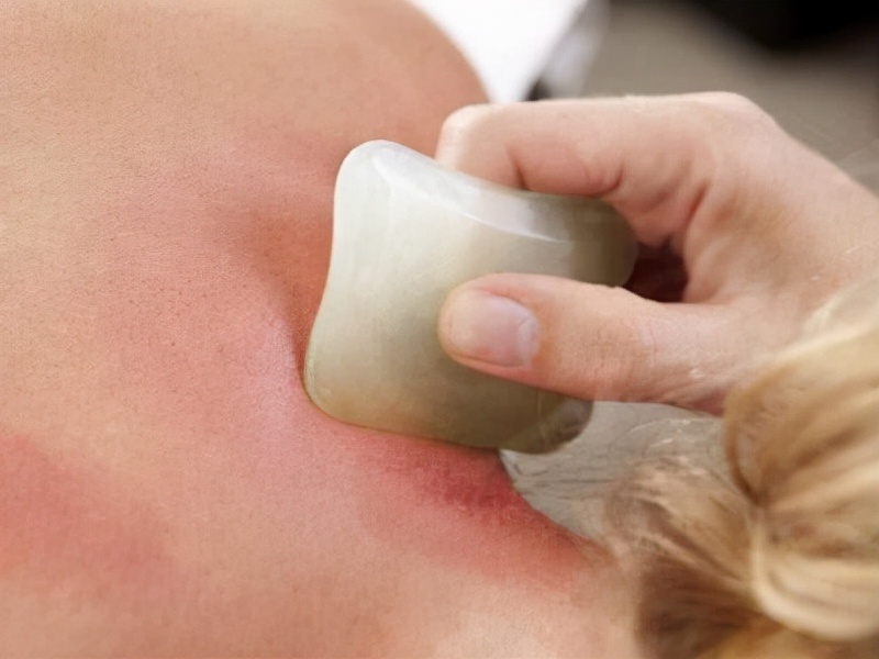 刮痧究竟是真养生，还是伪科学？刮出来的“痧”，到底是什么？