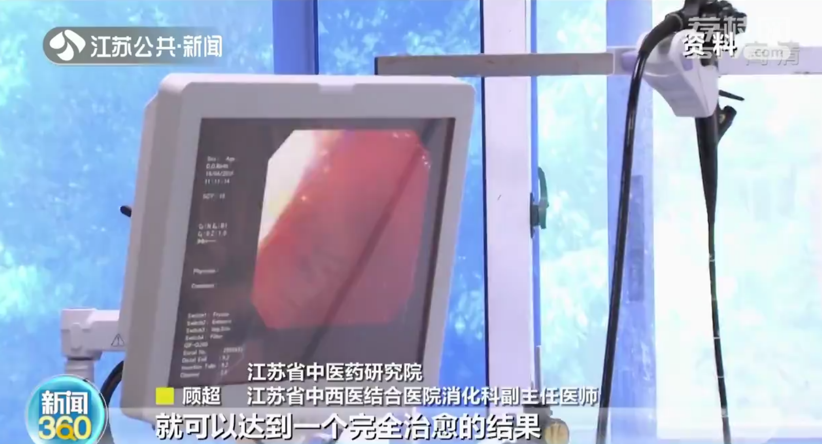 陪丈夫复查妻子查出早期胃癌 40岁以上要重视胃肠镜检查