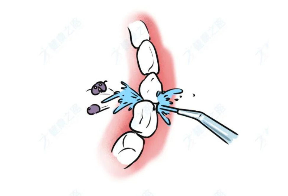 电动牙刷真的有用吗？和普通牙刷有什么不同？别再被忽悠了