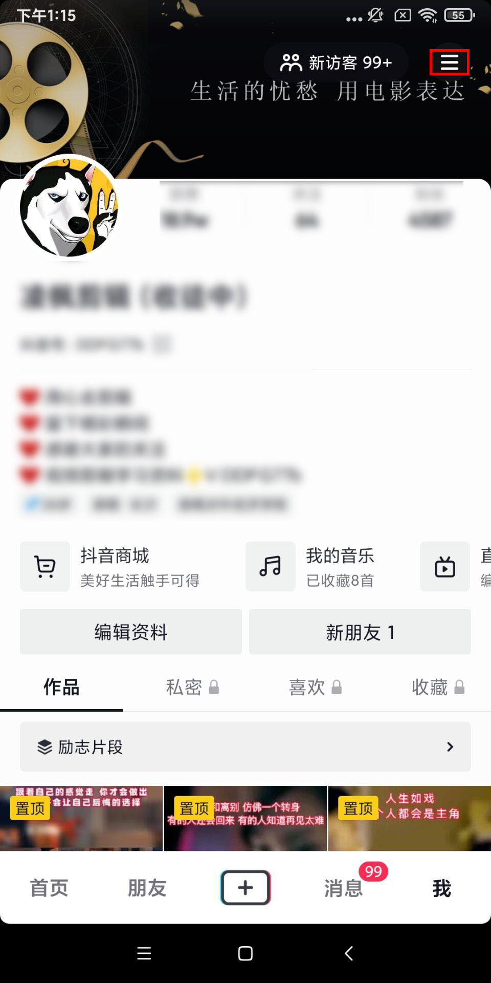 抖音怎么开店卖东西（抖音开通小黄车卖货基础知识）