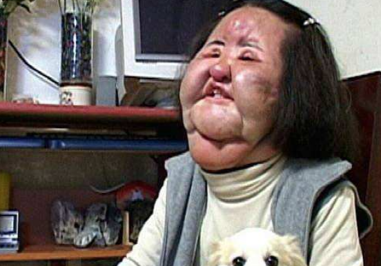 “畸形脸、电风扇脸”，10位整容过度的女星，有人直接命丧手术台