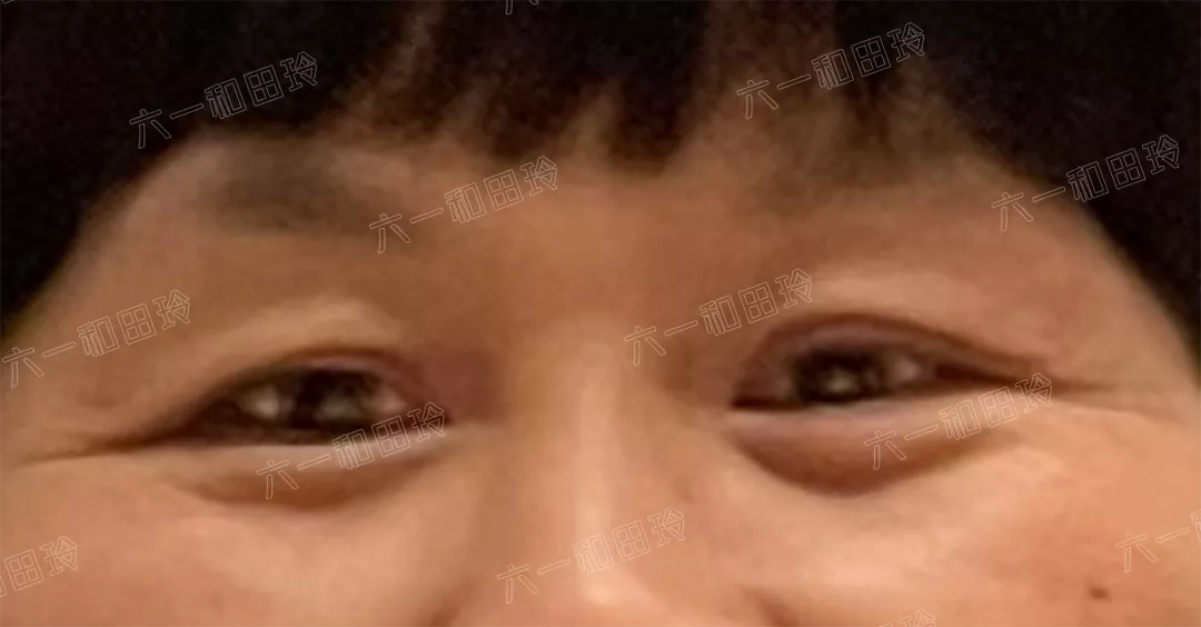 过年给妈妈最好的礼物，就是隐形眉眼提升