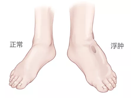 唯一主打祛湿的中成药，从根断湿气，调理12种疾病，适合所有人