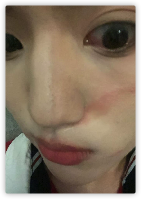 25岁男星被指控打人！直接拿碗砸向好友，受害者脸上伤痕令人后怕
