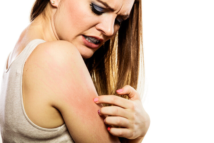 过敏体质的人免疫力更高，不易患癌？这4种人才是癌症高发人群