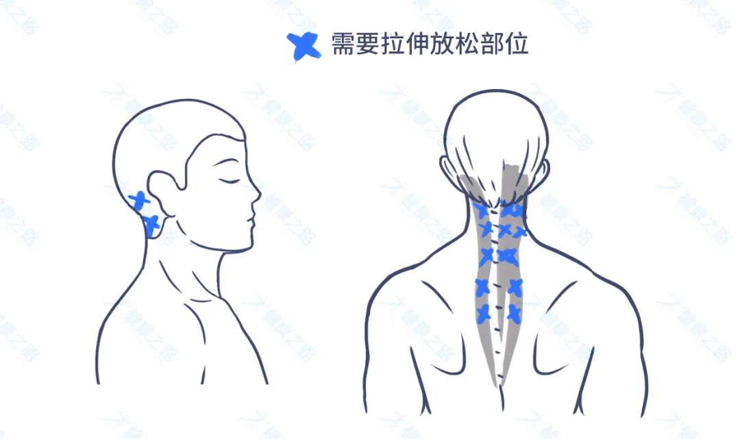 1个马上缓解头痛的方法，简单有效，还能预防颈椎病