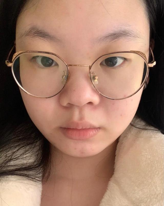 这种圆滚滚的鼻子会让我们的整个五官和脸部轮廓都缺少一种精致感