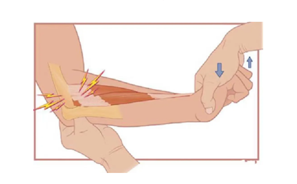 手肘痛怎麼辦 女性右手肘關節疼痛是什麼原因 - 汽車時代網